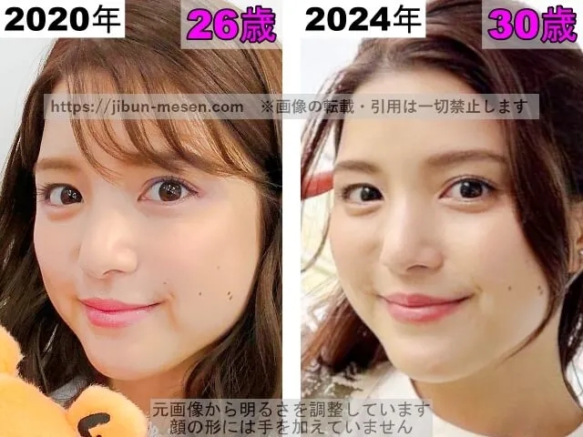 川島海荷の目の整形検証2020年~2024年