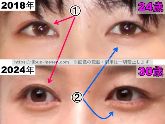 清野菜名の目の整形検証2018年～2024年（拡大）