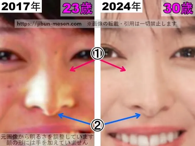 清野菜名の鼻の整形検証2017年～2024年（拡大）