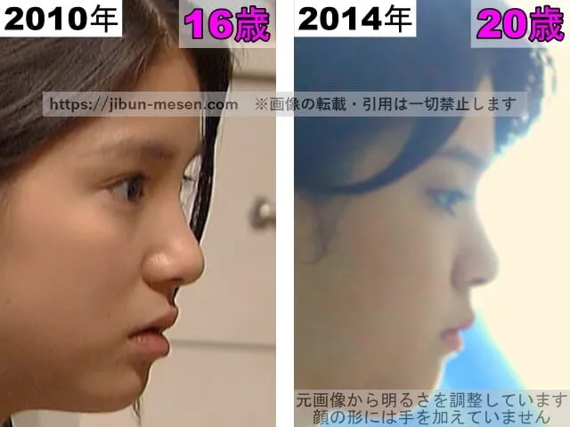 川島海荷の鼻の整形検証2010年~2014年(横顔)