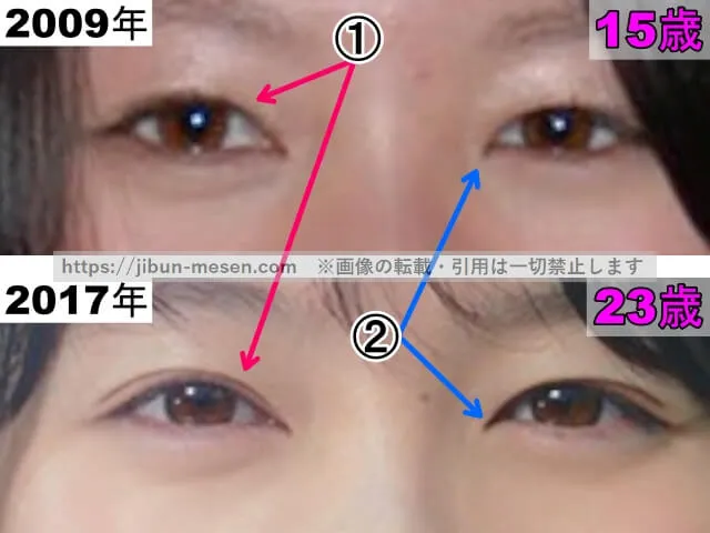 清野菜名の目の整形検証2009年～2017年（拡大）