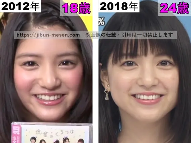 川島海荷の唇の整形検証2012年～2018年