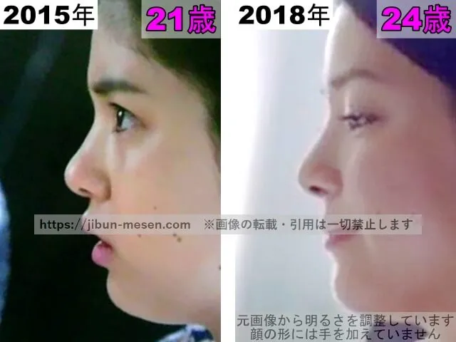 川島海荷の鼻の整形検証2015年~2018年(横顔)