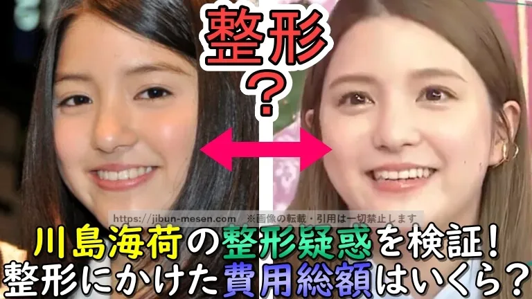 川島海荷の整形疑惑を検証！整形にかけた費用総額はいくら？