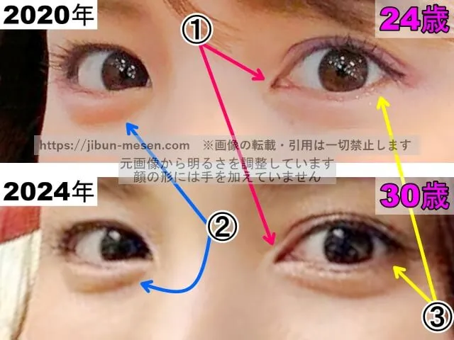 川島海荷の目の整形検証2020年~2024年(拡大)