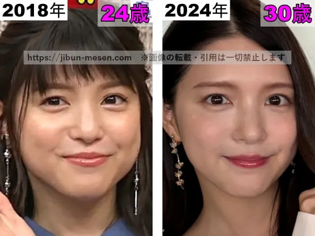 川島海荷の唇の整形検証2018年～2024年