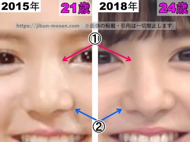 川島海荷の鼻の整形検証2015年~2018年(拡大)