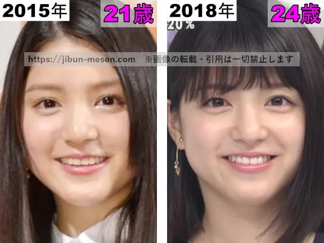 川島海荷の鼻の整形検証2015年~2018年