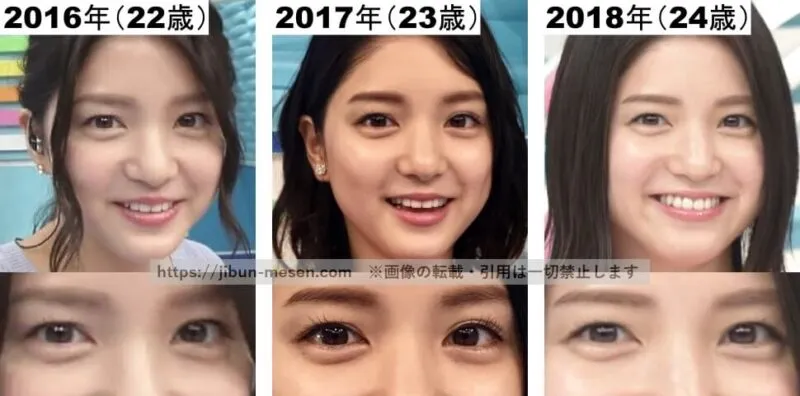 涙袋が膨らんでいる川島海荷