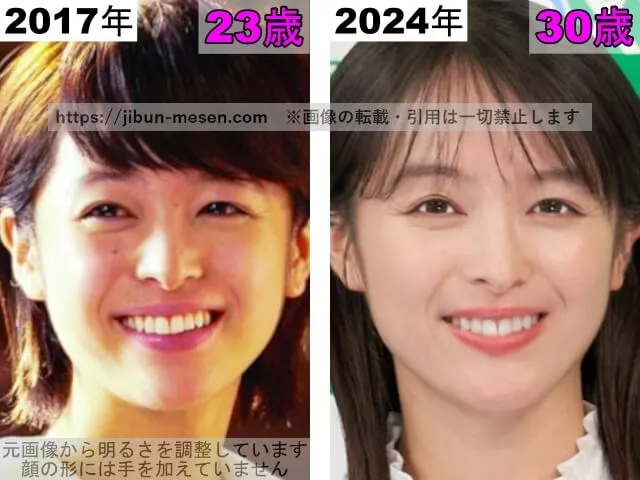 清野菜名の鼻の整形検証2017年～2024年