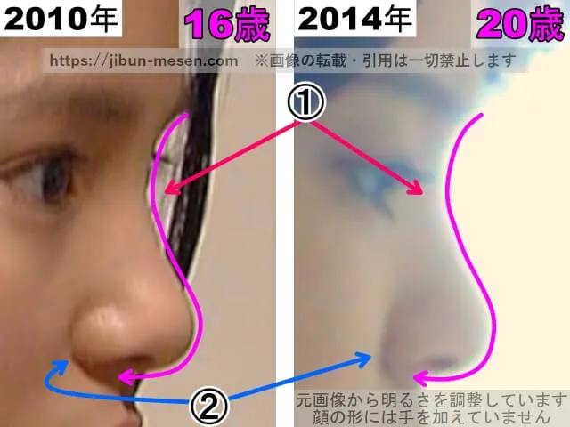 川島海荷の鼻の整形検証2010年~2014年(横顔・拡大)