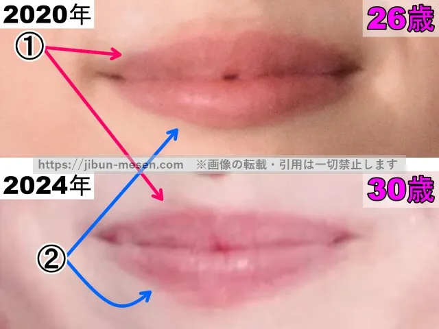 清野菜名の唇の整形検証2020年～2024年（拡大）