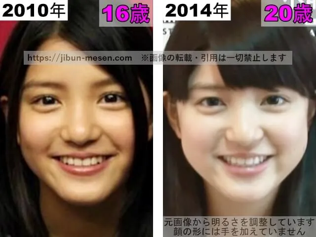 川島海荷の鼻の整形検証2010年~2014年