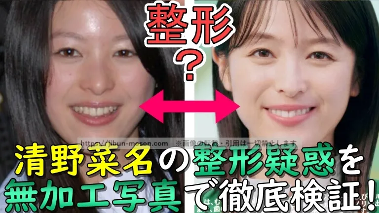 清野菜名の整形疑惑を無加工写真で徹底検証！