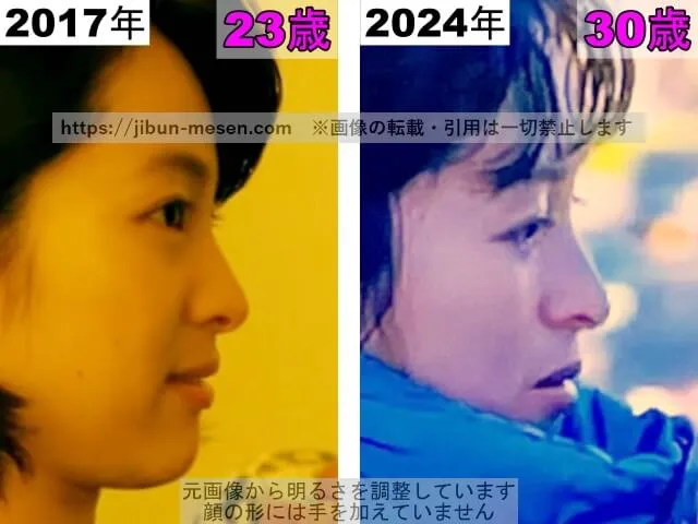 清野菜名の鼻の整形検証2017年～2024年（横顔）