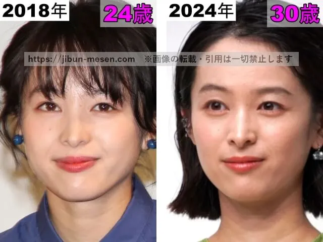 清野菜名の目の整形検証2018年～2024年