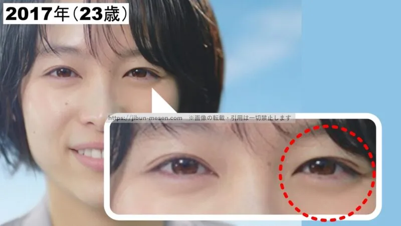 清野菜名の二重まぶた（2017年）