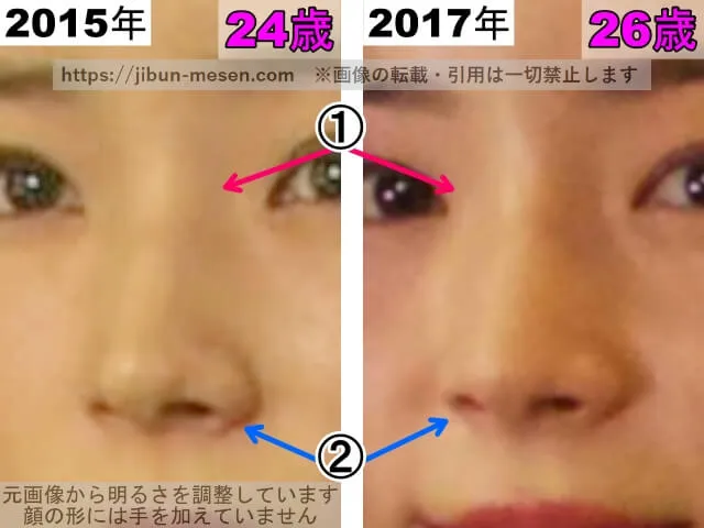 蓮佛美沙子の鼻の整形検証2015年〜2017年(拡大)
