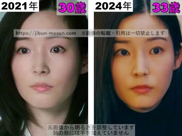 蓮佛美沙子の唇の整形検証2021年〜2024年