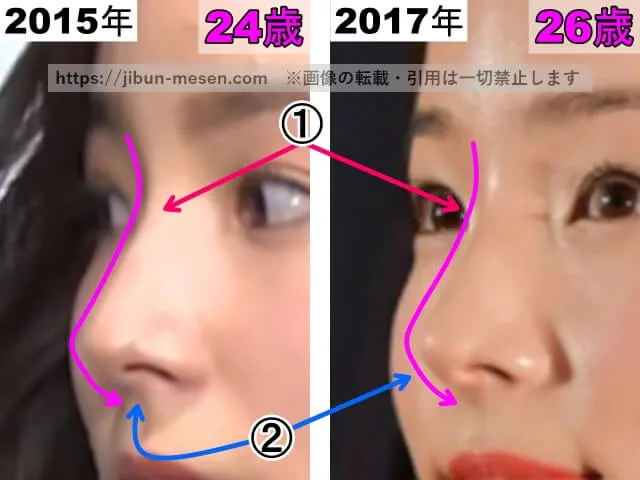 蓮佛美沙子の鼻の整形検証2015年〜2017年(横顔・拡大)