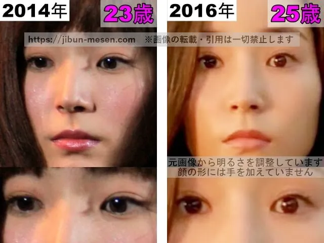 蓮佛美沙子の二重まぶたの比較2014年〜2016年