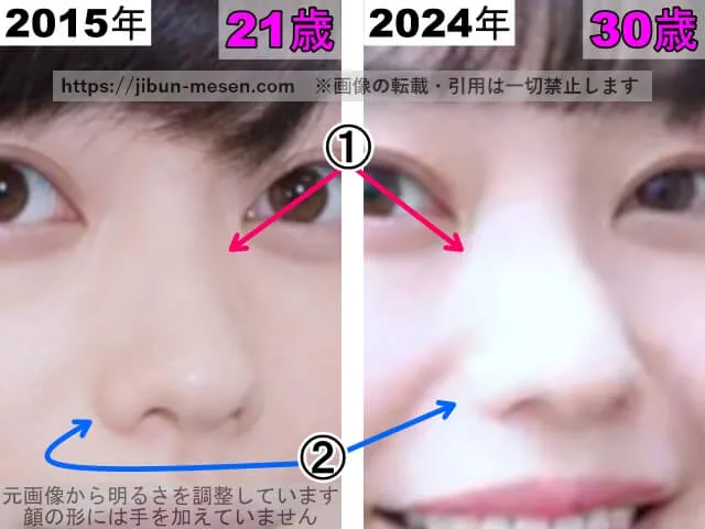 冨手麻妙の鼻の整形検証2015年~2024年(拡大)