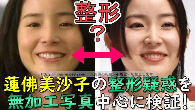 整形？蓮佛美沙子の整形疑惑を無加工写真中心に検証！