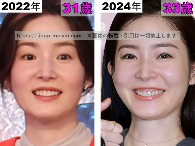蓮佛美沙子の鼻の整形検証2022年〜2024年