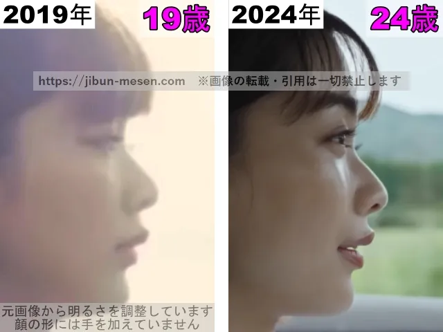 見上愛の鼻の整形検証2019年～2024年（横顔）その2