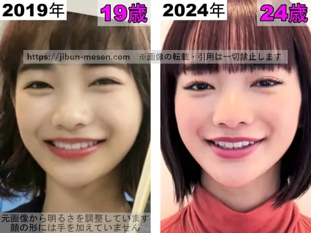 見上愛の鼻の整形検証2019年～2024年