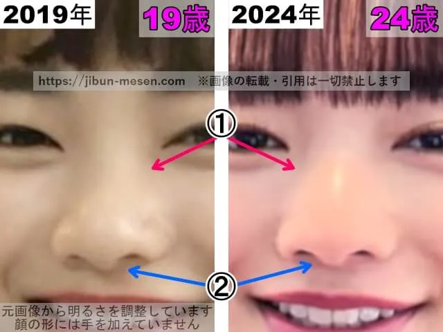 見上愛の鼻の整形検証2019年～2024年（拡大）