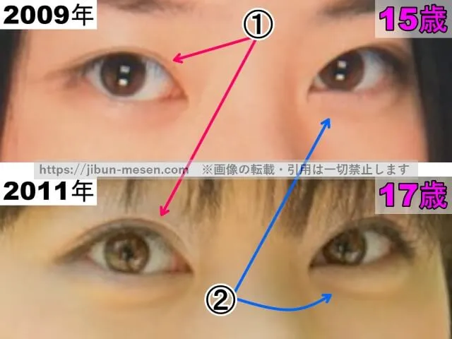 冨手麻妙の目の整形検証2009年~2011年(拡大)