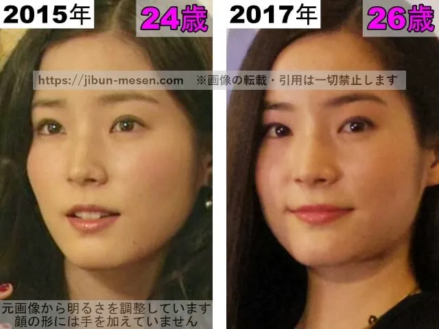 蓮佛美沙子の鼻の整形検証2015年〜2017年