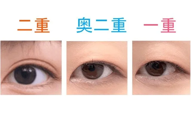 まぶたの種類（モデルプレスHPより引用）※現在はリンク切れ