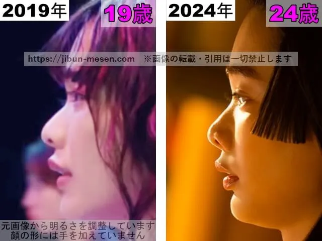 見上愛の鼻の整形検証2019年～2024年（横顔）