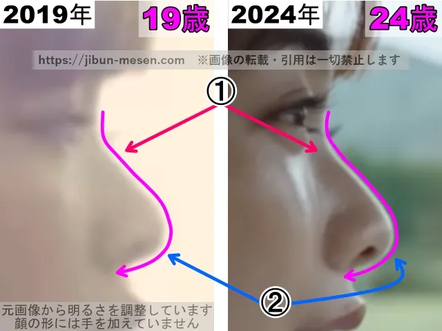 見上愛の鼻の整形検証2019年～2024年（横顔・拡大）その2