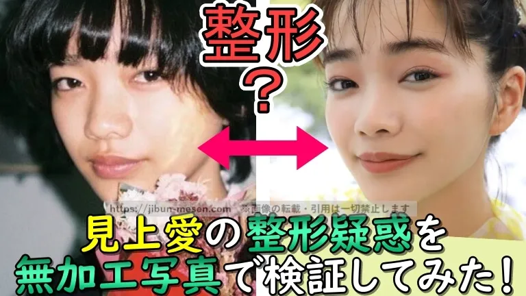 見上愛の整形疑惑を無加工写真で検証してみた！