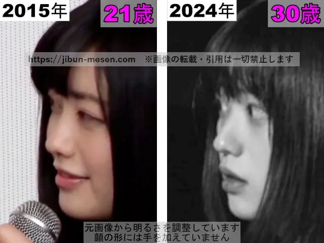 冨手麻妙の鼻の整形検証2015年~2024年(横顔)