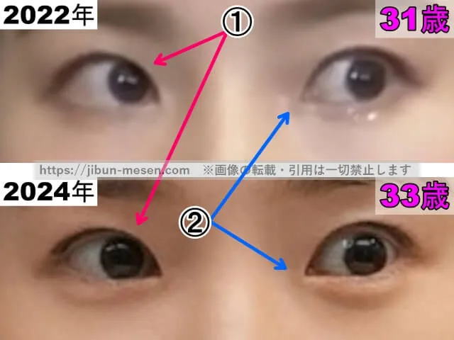 蓮佛美沙子の目の整形検証2022年〜2024年（拡大）