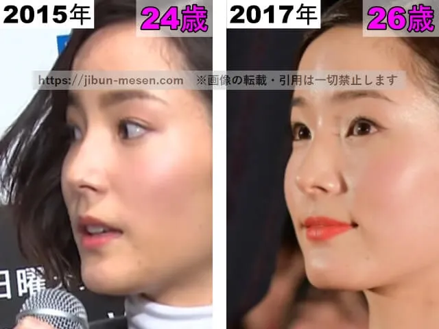 蓮佛美沙子の鼻の整形検証2015年〜2017年(横顔)