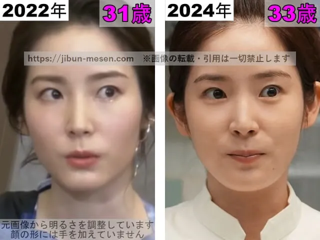 蓮佛美沙子の目の整形検証2022年〜2024年