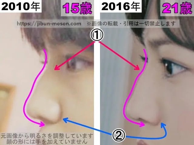 川口春奈の鼻の整形検証2010年~2016年(横顔・拡大)
