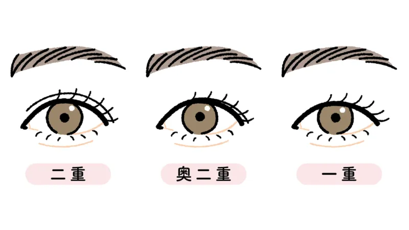 二重まぶたの種類(紀尾井町プラザクリニックHPより引用)