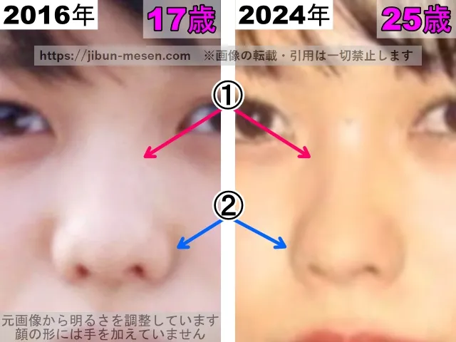 志田彩良の鼻の整形検証2016年～2024年（拡大）