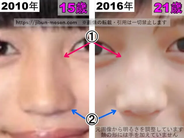 川口春奈の鼻の整形検証2010年~2016年(拡大)