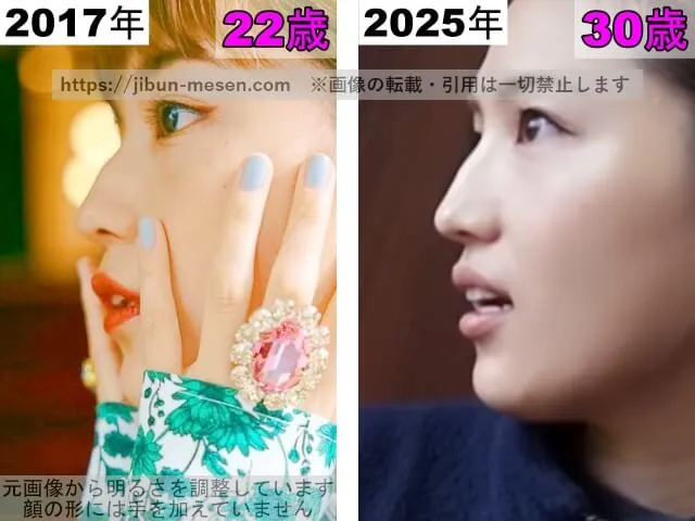 川口春奈の鼻の整形検証2017年~2025年(横顔)