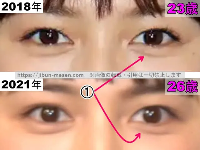 川口春奈の目の整形検証2018年～2021年（拡大）