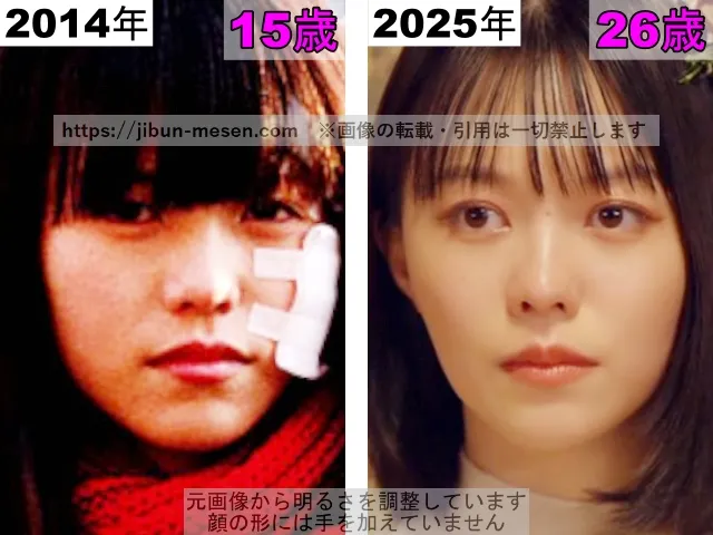 志田彩良の唇の整形検証2014年～2025年