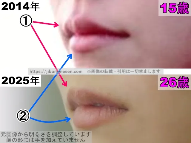 志田彩良の唇の整形検証2014年～2025年（横顔・拡大）