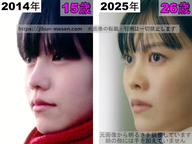 志田彩良の唇の整形検証2014年～2025年（横顔）